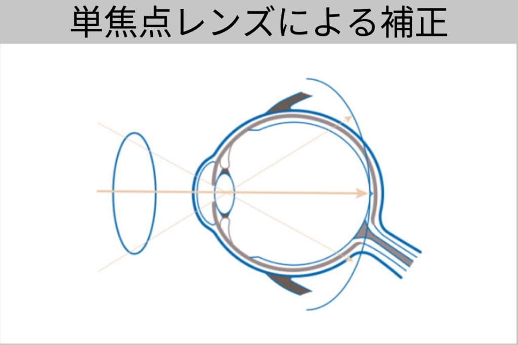 単焦点レンズによる補正