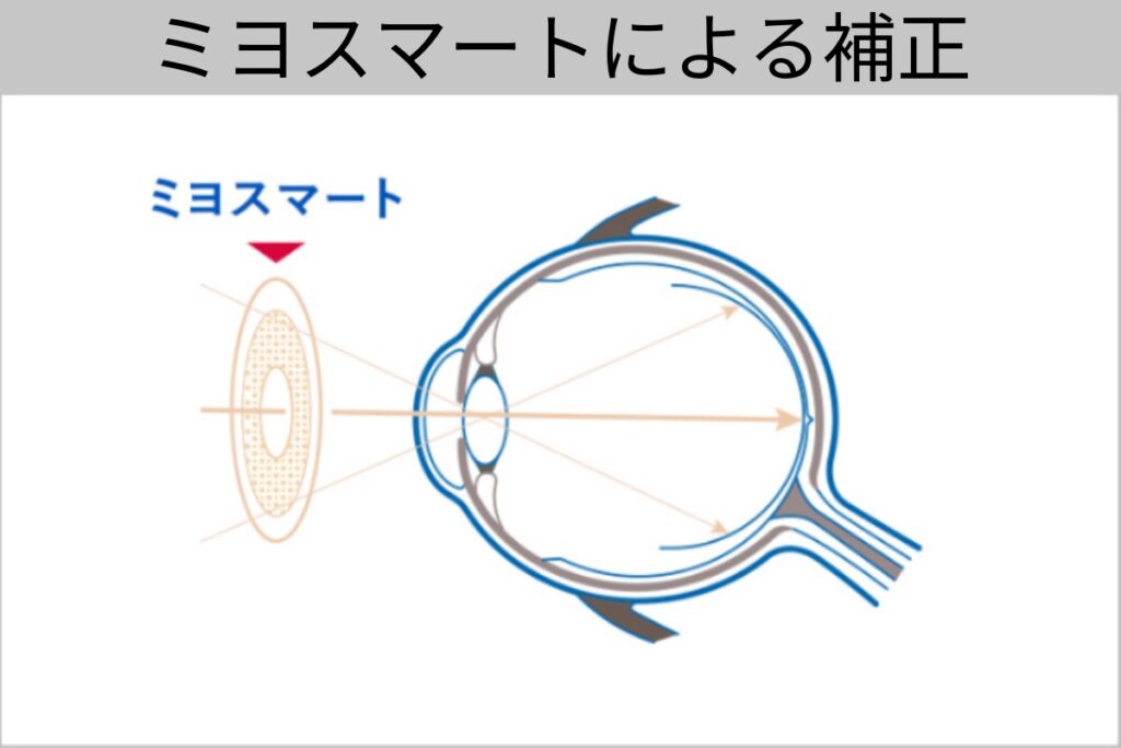 ミヨスマートによる補正
